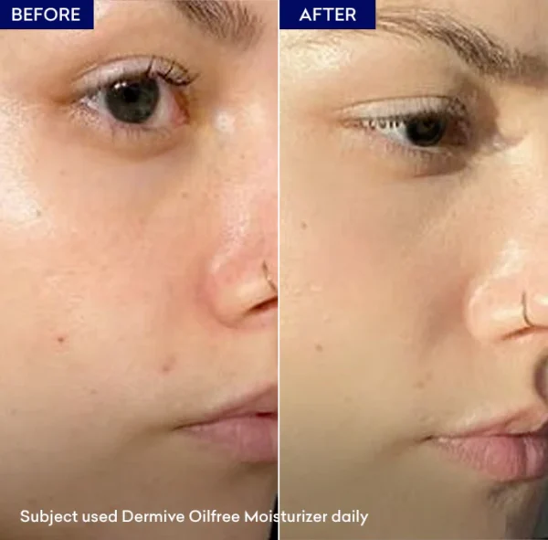 Dermive Oil Free Moisturizer thumbnail new